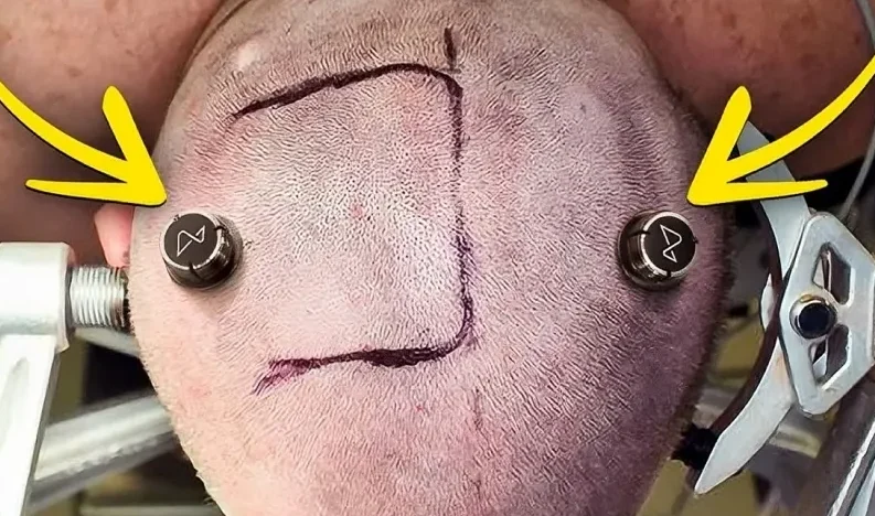 تولید انبوه Neuralink در 2026؛ اتصال مستقیم مغز و ماشین